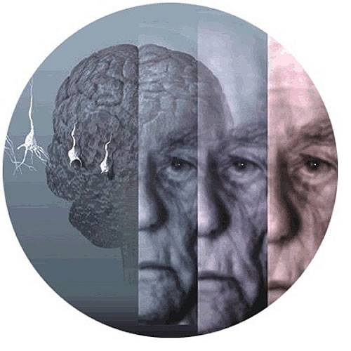 Старение мозга - одна из причин старения