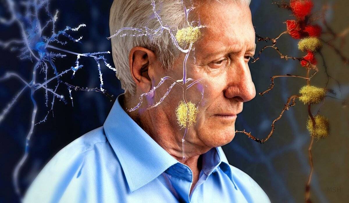 12 вещей, вызывающих старение головного мозга